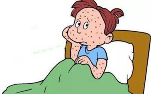 ˮ��֢״ ��ˮ��Ҫע��ʲô